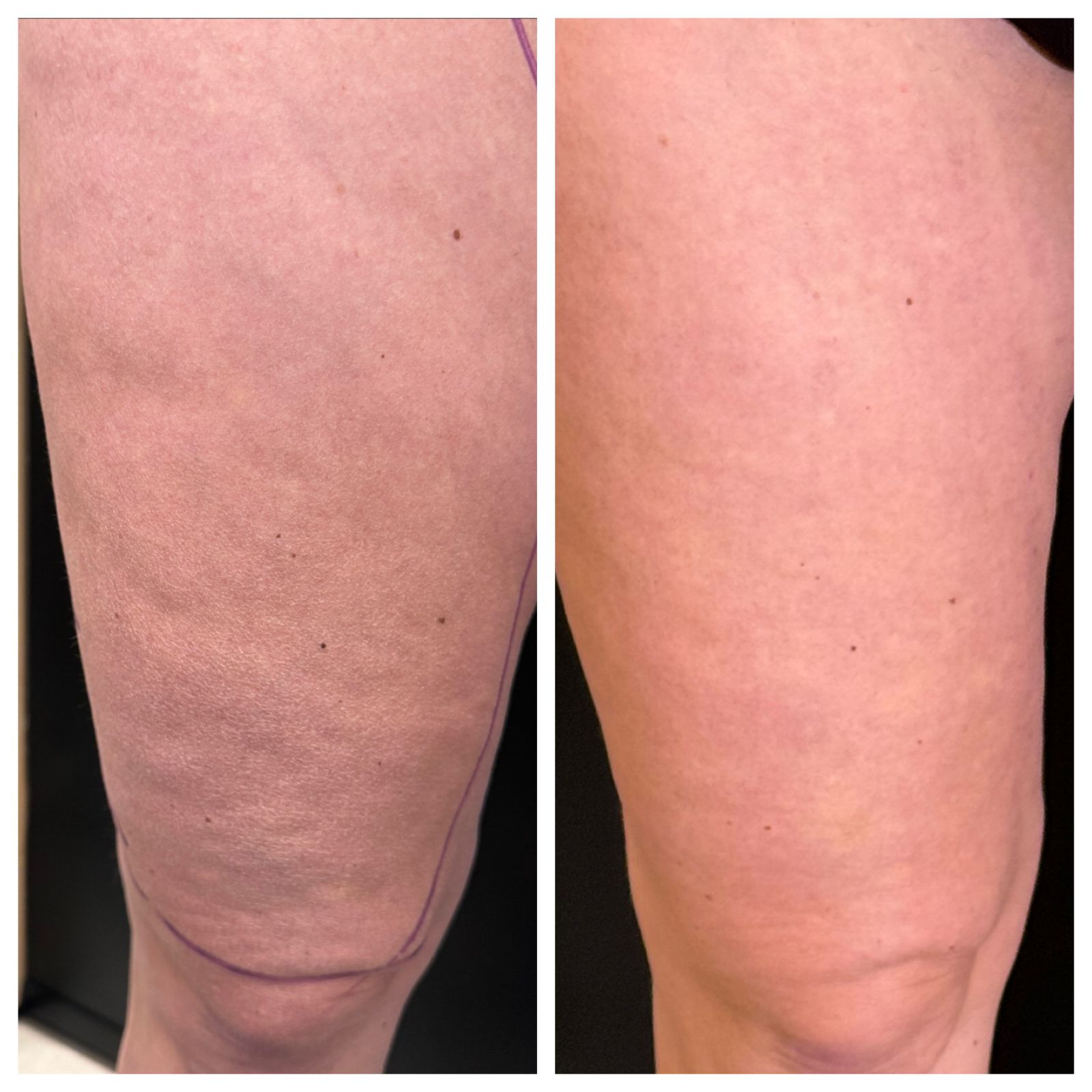 WhatsApp Image 2024-07-26 at 11.05.28